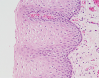 Průřez stěnou jícnu (A - epitel, B - mukóza, C - sval)