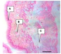 Průřez stěnou jícnu (A - epitel, B - mukóza, C - sval)