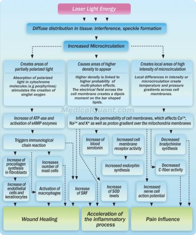Schéma stimulačního účinku laseru